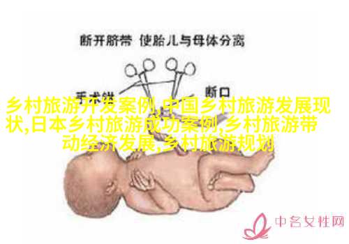 活性炭過濾系統
