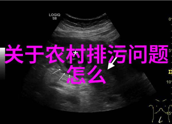 公共场所健康守护者分析核酸自助采样机对防疫工作的影响